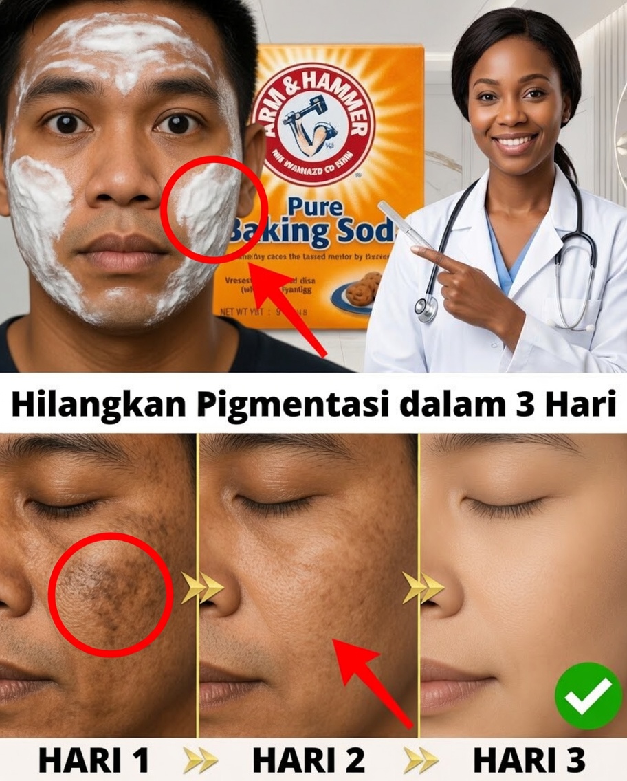 Krim Bikarbonat Buatan Sendiri: Ucapkan Selamat Tinggal pada Kerutan dan Flek Hitam