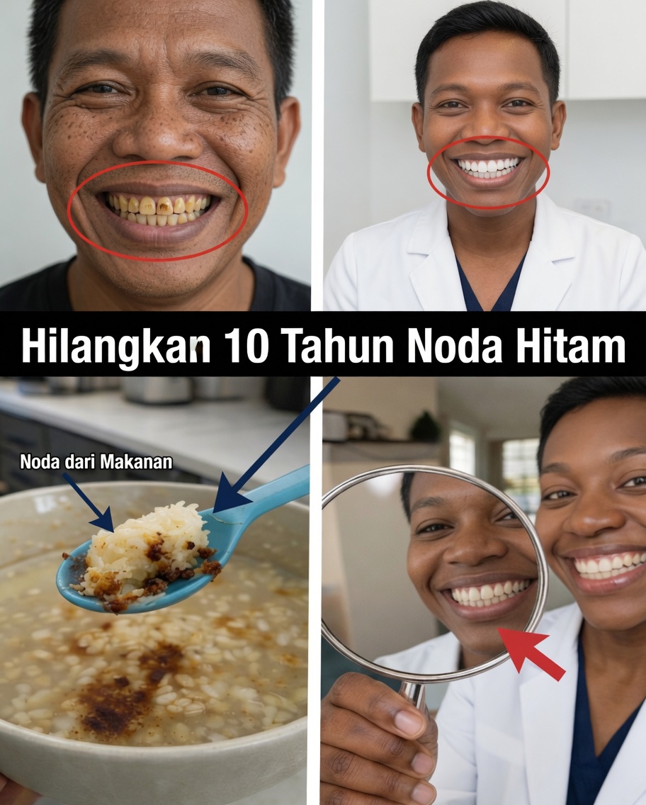 Dalam 2 Menit Hilangkan 10 Tahun Noda pada Gigi? Kebenaran yang Akan Mengejutkan Anda