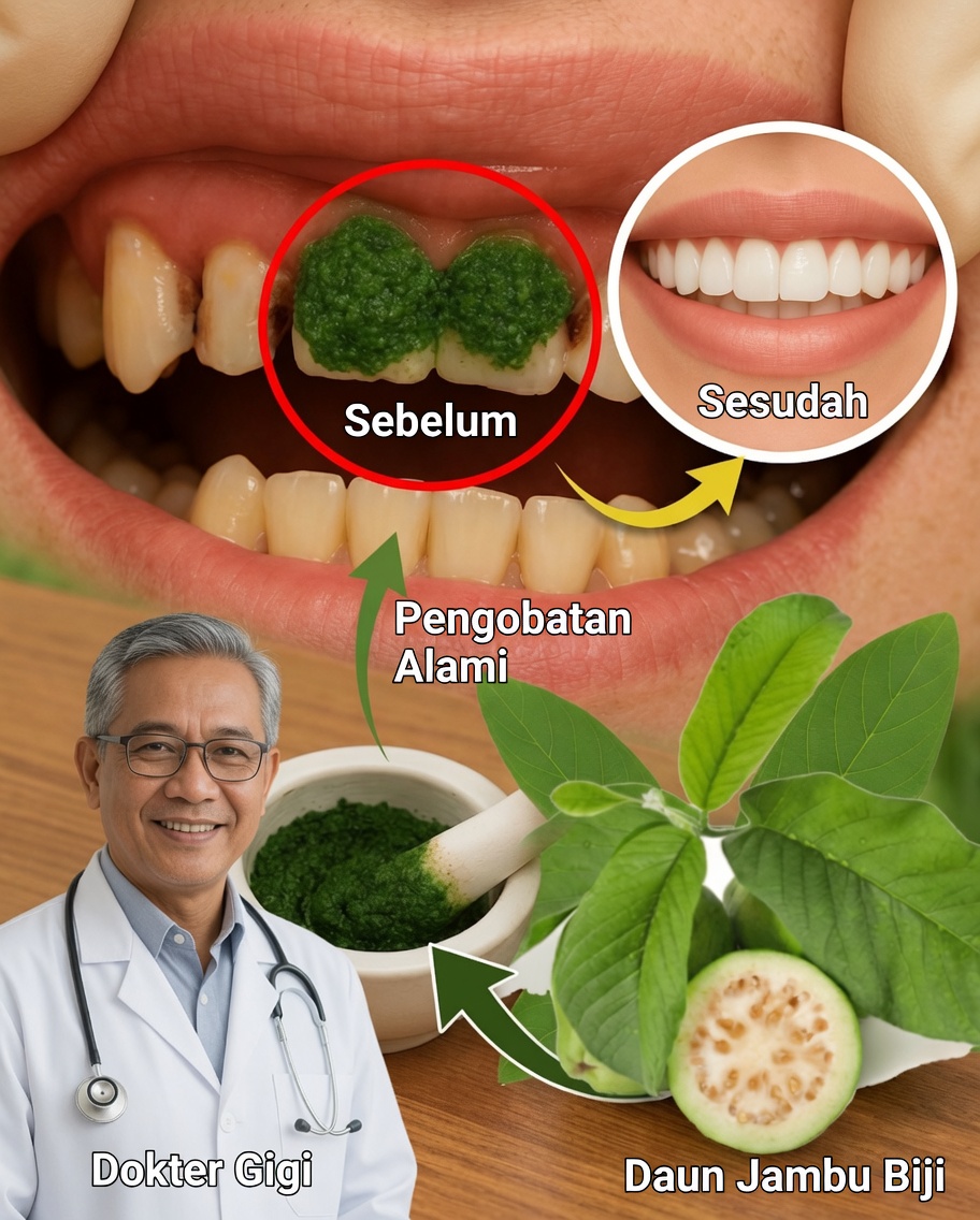 3 Maneira Ampuh Daun Jambu Biji Melawan Karies Gigi