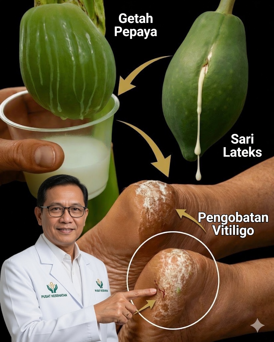 18 Manfaat Mengejutkan dari Lateks Pepaya (Getah Pepaya) dan Cara Menggunakannya