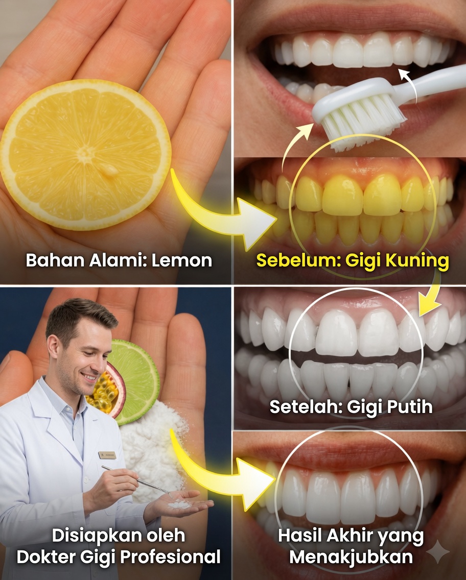 Buka Senyum yang Lebih Putih dengan Lemon dan Soda Kue