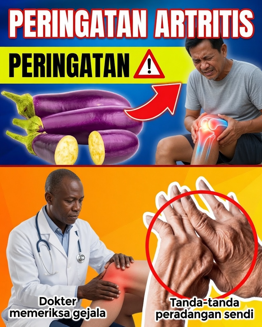 7 Makanan yang Memicu Peradangan yang Harus Dihindari oleh Penderita Arthritis untuk Mengurangi Nyeri Sendi