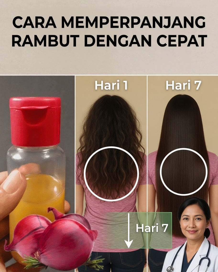 Cara Membuat Minyak Bawang untuk Pertumbuhan Rambut Cepat dan Menghentikan Kerontokan