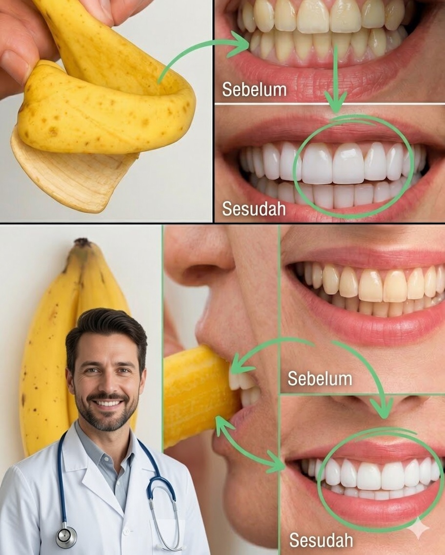 Cerahkah Senyummu Hanya dalam 2 Menit dengan Kulit Pisang