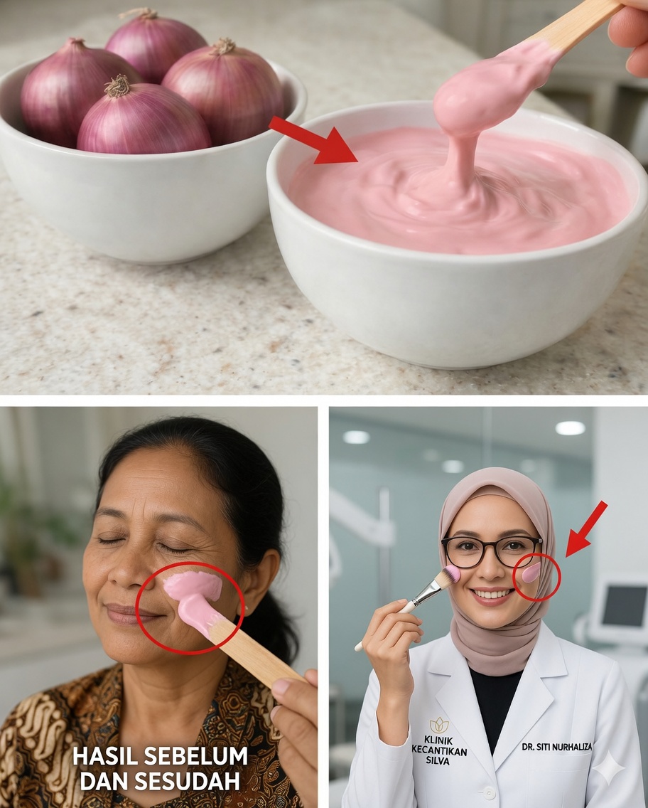 Kekuatan Mengejutkan Bawang Merah Muda untuk Kulit yang Lebih Halus dan Awet Muda