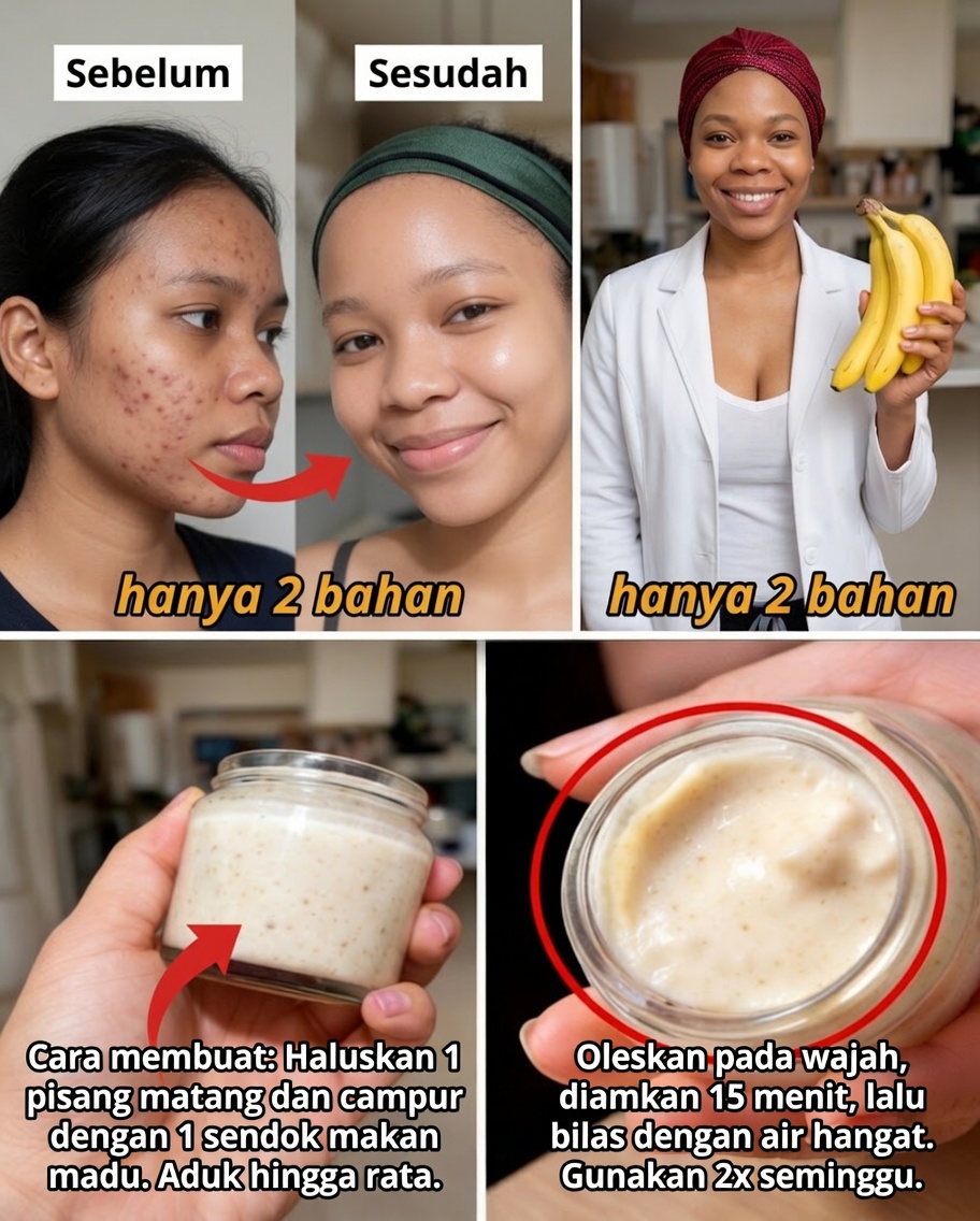 7 Cara Alami untuk Menghaluskan Garis Halus dan Mencerahkan Kulit Menggunakan Kulit Pisang