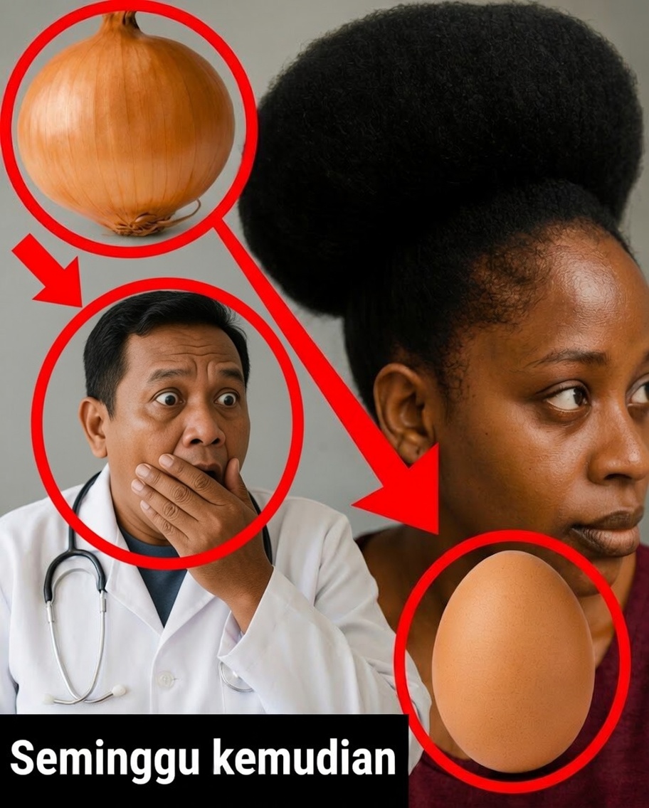 Rangsang Pertumbuhan Rambut dengan Kekuatan Minyak Bawang Bombay
