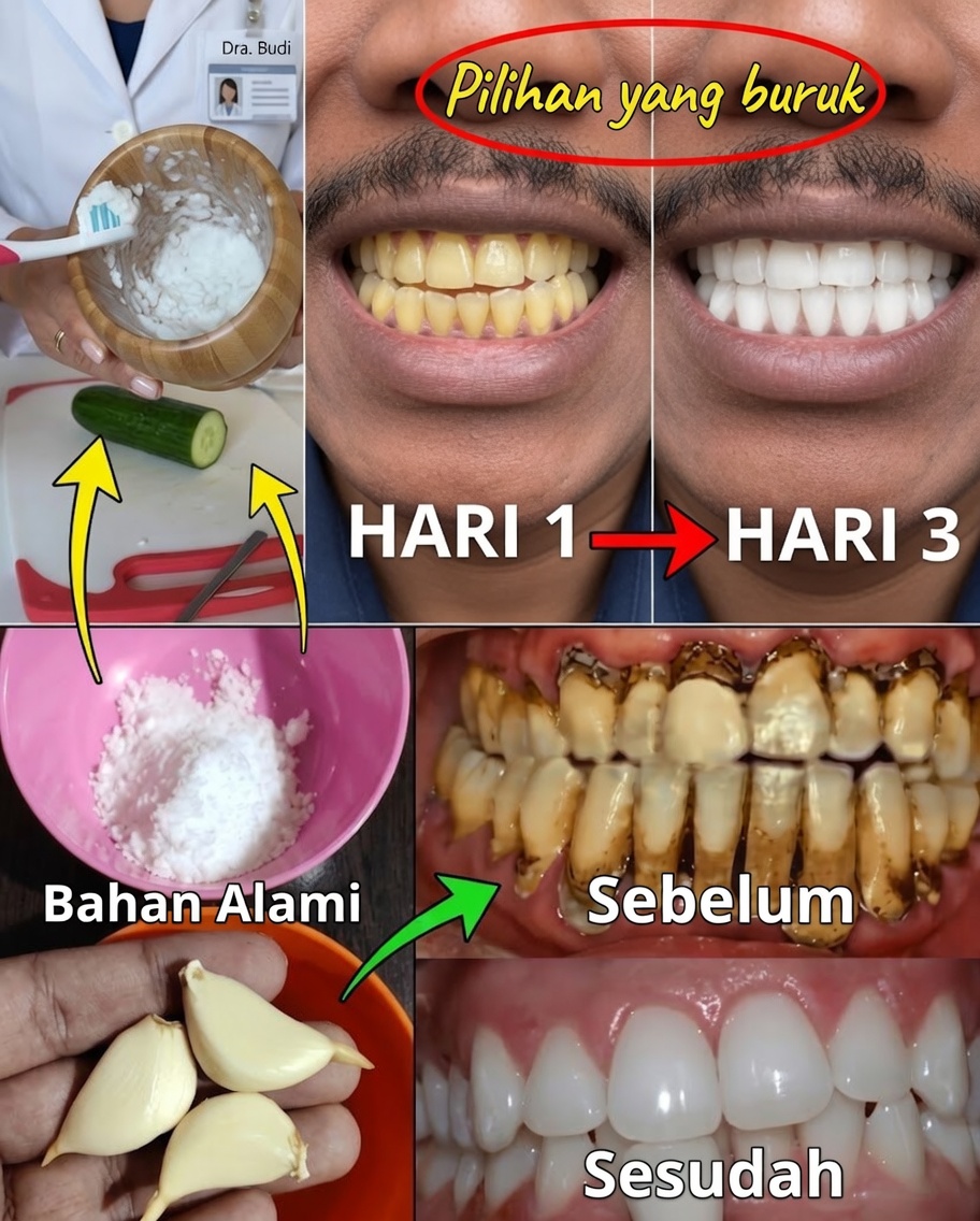 Tersenyumlah Seperti Tak Pernah Sebelumnya: Temukan Rahasia untuk Senyum Mempesona di Rumah