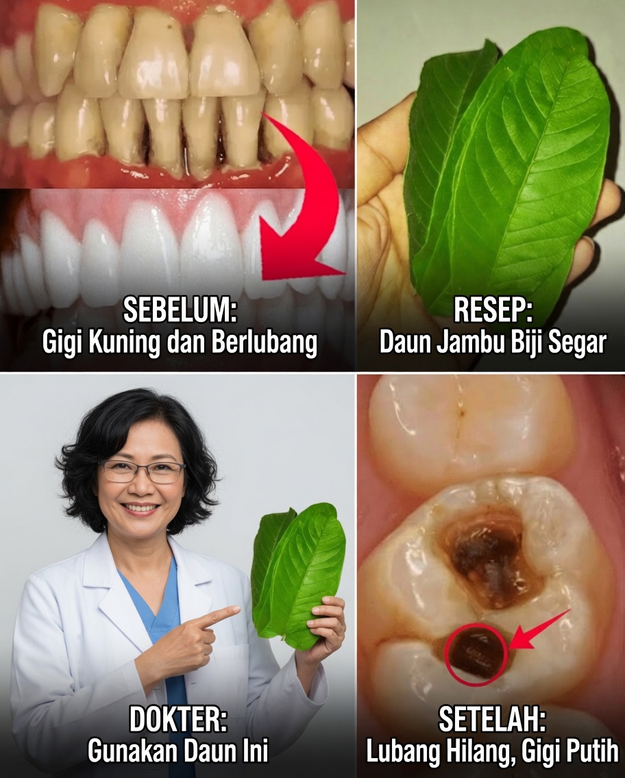 3 Cara Sederhana dan Ekonomis untuk Mengobati Karies Gigi dengan Daun Jambu Biji