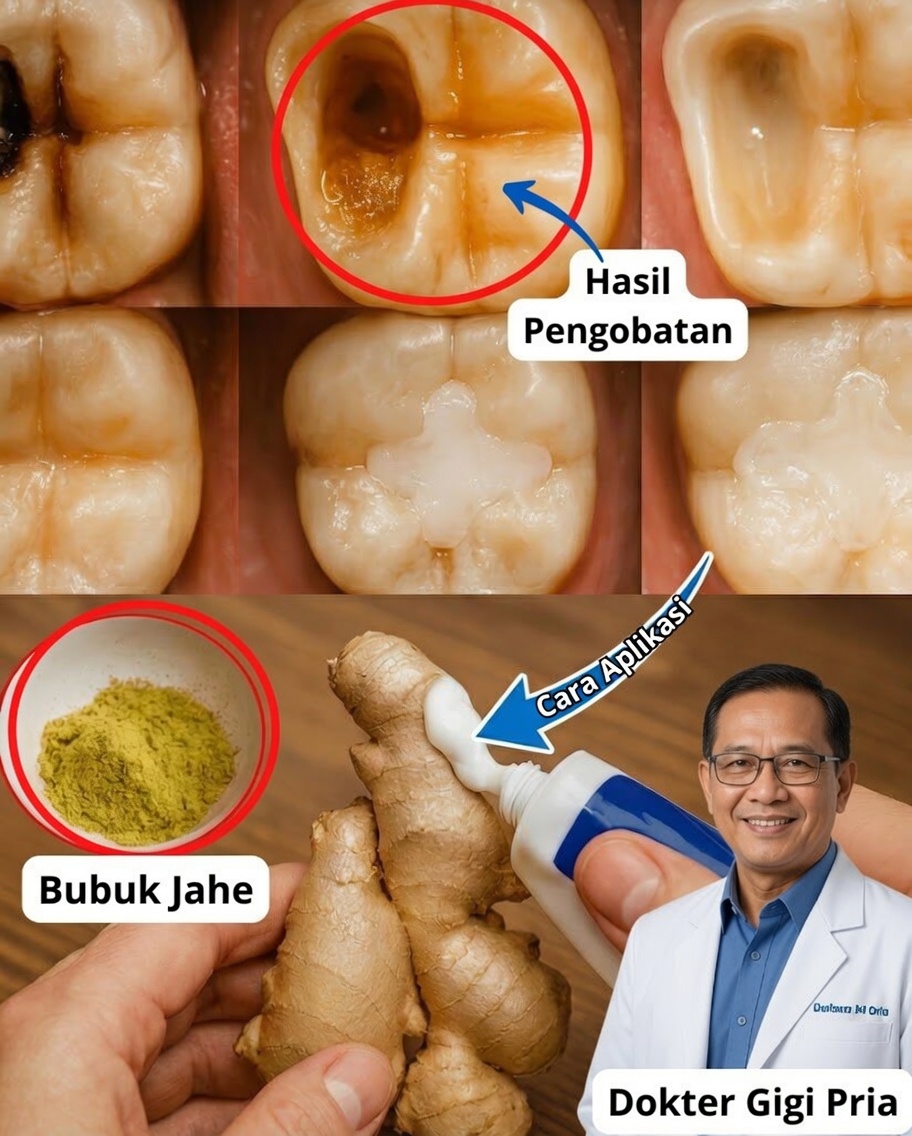Lelah dengan Karies? Temukan Cara Menguatkan Gigi Anda Secara Alami