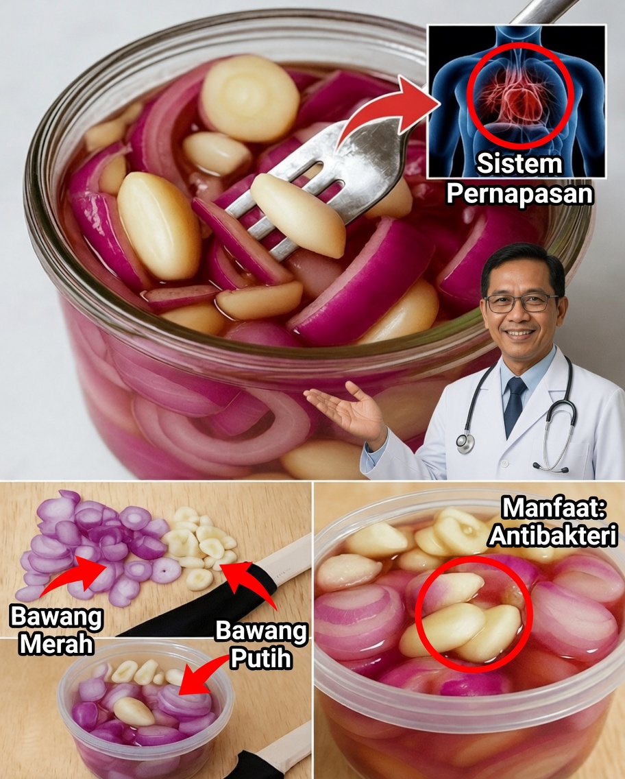 Bernapas Lebih Baik dengan Bawang Merah, Bawang Putih, dan Madu: Obat Alami untuk Paru-Paru