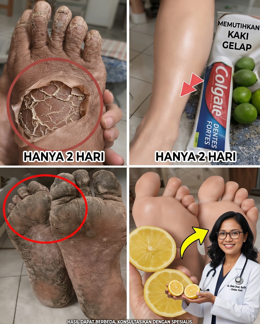 Kebiasaan Harian Sederhana yang Memperbaiki Tampilan Kaki Saya untuk Kulit yang Lebih Halus, Cerah, dan Sehat