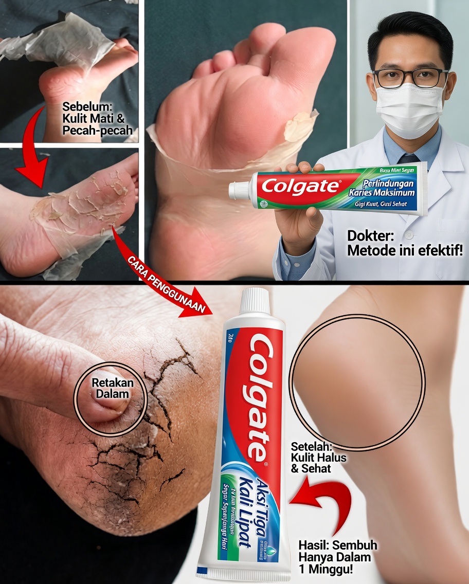 Rahasia Perawatan Kaki Colgate: Trik Sederhana untuk Kaki yang Lebih Lembut dan Sehat