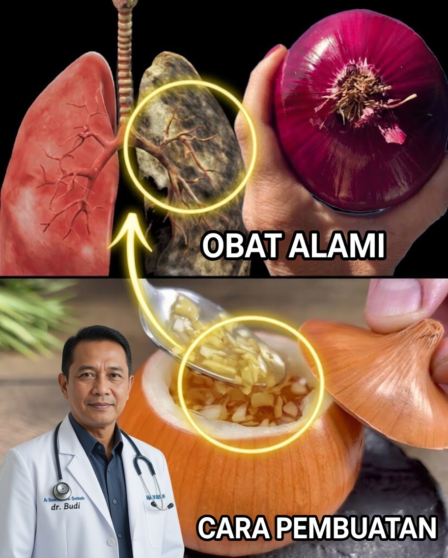 Antibiotik Bawang: Obat Alami Ampuh untuk Batuk, Bronkitis, dan Pneumonia