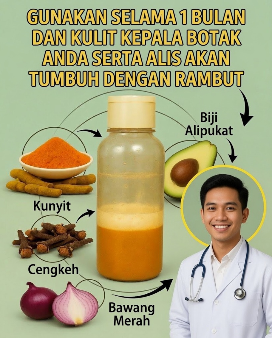 Resep Sampo Ajaib: Kunyit, Cengkeh, Bawang, dan Biji Alpukat