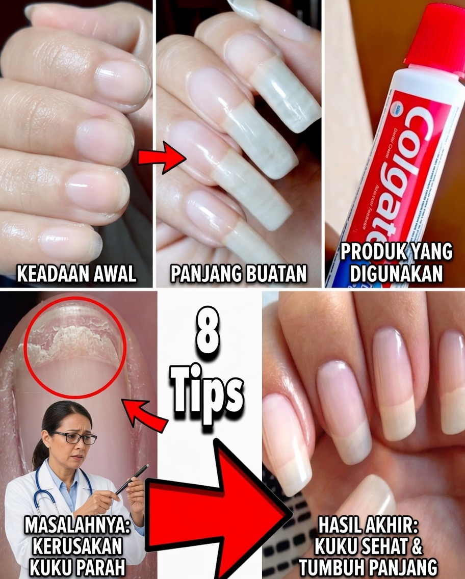 Pulihkan Kuku Rapuh Secara Alami: Rahasia Bawang Putih yang Ampuh untuk Kuku Lebih Kuat dan Sehat