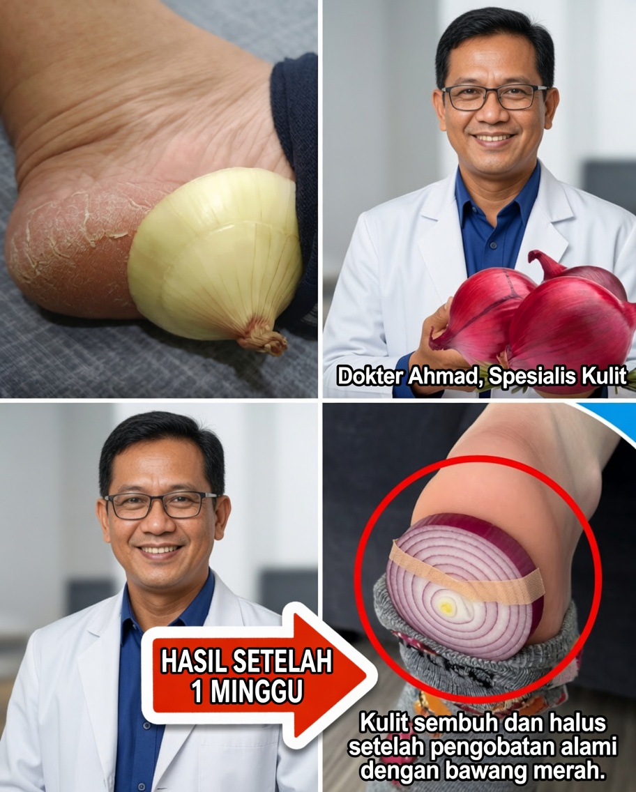 Bawang dalam Kaus Kaki: Obat Alami yang Mengejutkan Sederhana untuk Meredakan Pilek dan Flu