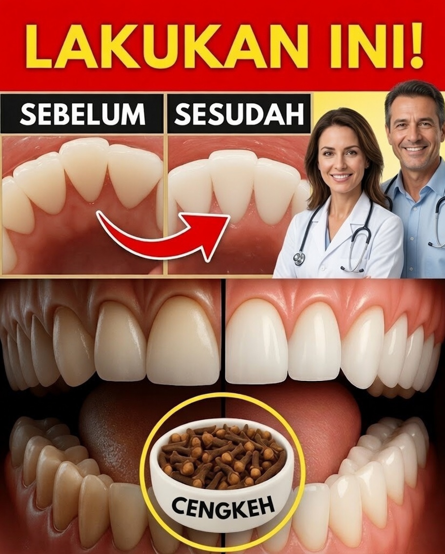 9 Obat Rumahan Terbukti untuk Menghilangkan Plak dan Karang Gigi Secara Alami