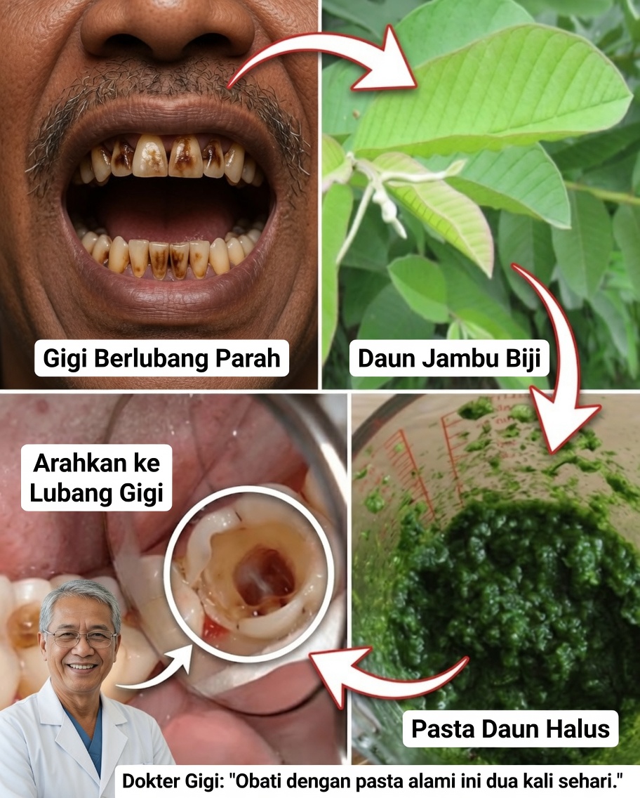 Daun Jambu Biji untuk Senyum Berseri: Rahasia Perawatan Mulut Alami Warisan Nenek Berusia 70 Tahun