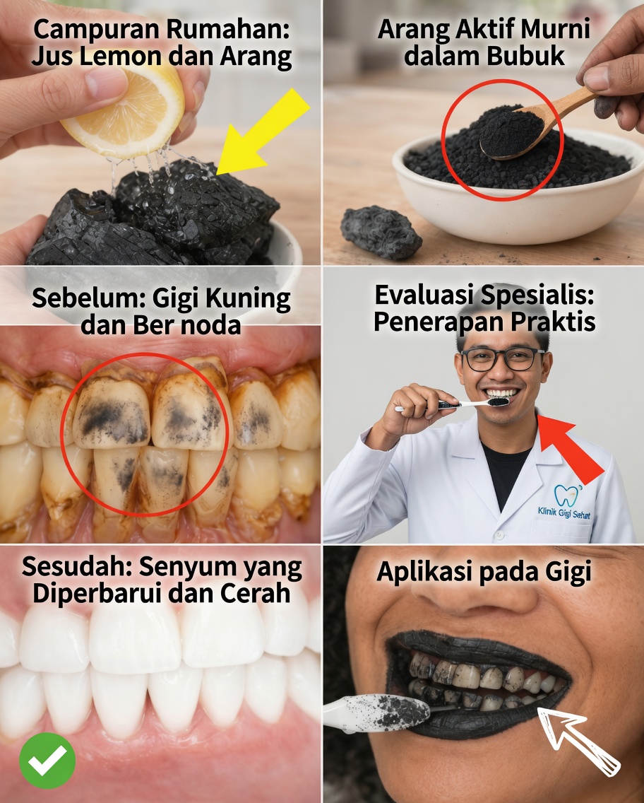 Cara Memutihkan Gigi dengan Aman: Kebenaran tentang Arang dan Lemon (dan Apa yang Benar-Benar Berhasil)