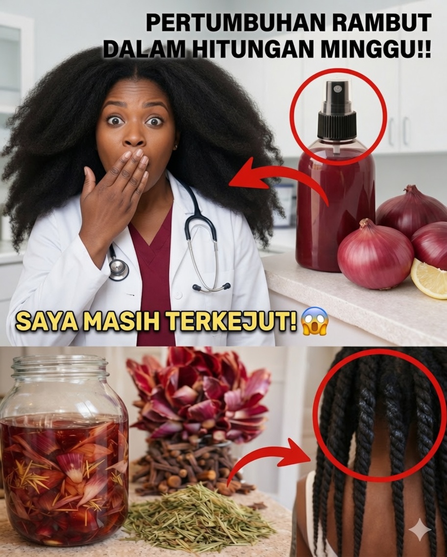 Buka Pertumbuhan Rambut Lebih Cepat: Kekuatan Campuran Bawang dan Cengkeh